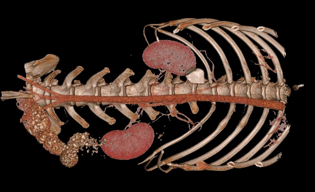 3d reconstruction of veterinary ct showing kidneys and large stone